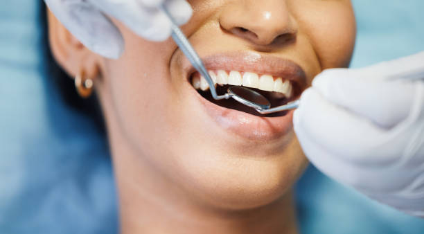 Best Emergency Tooth Extraction in Janesville, CA
